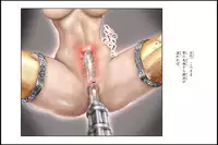 [NEO’GENTLE] Bishoujo Fighter Onaho - Onaho Ninshin Kakutei Hen