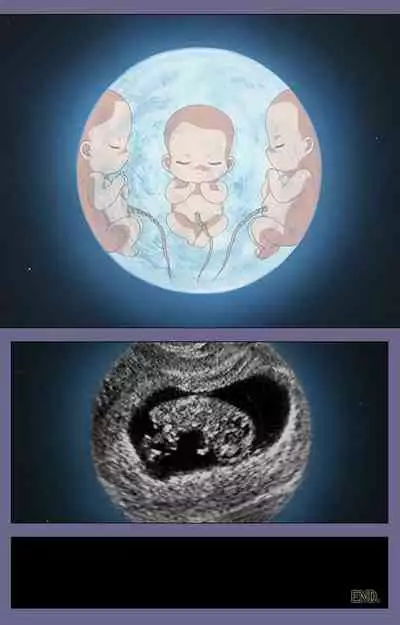 [BLACK PACKAGE TRY] [Full Color seijin ban] Ryoujoku no rensa ~ fueru emome to kasoku suru akugyō ~ Kanzenban